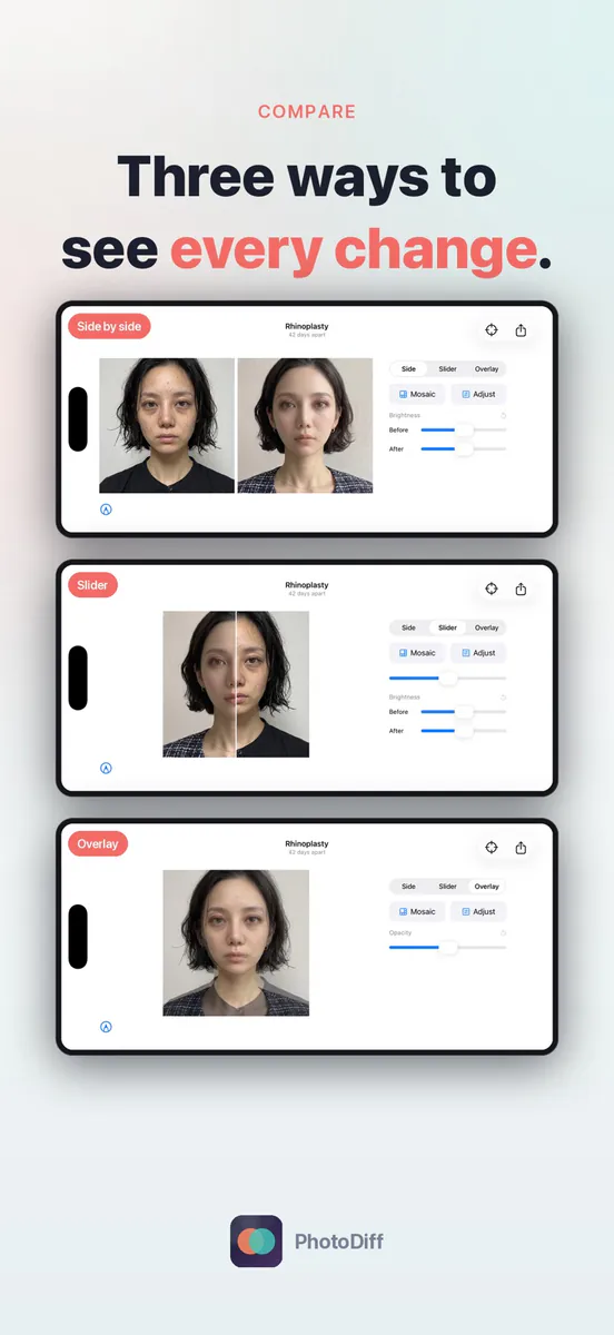 PhotoDiff: 비포애프터 사진비교 App Store 공개 화면 1