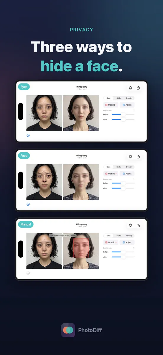 PhotoDiff: 비포애프터 사진비교 App Store 공개 화면 2