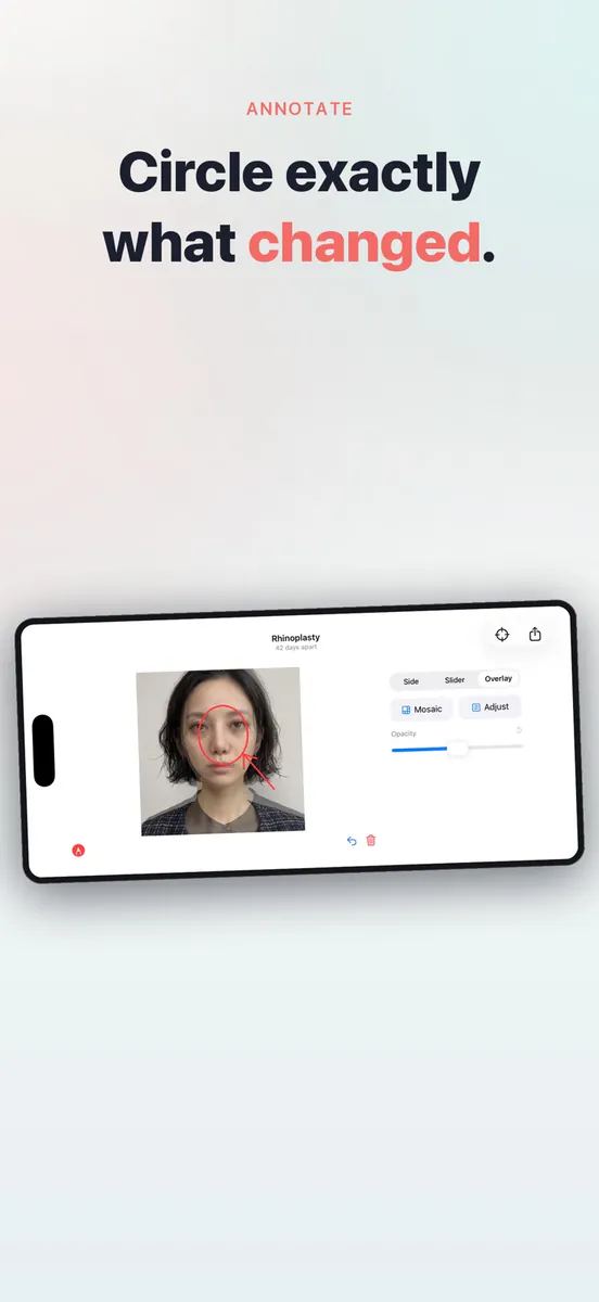 PhotoDiff: 비포애프터 사진비교 App Store 공개 화면 3